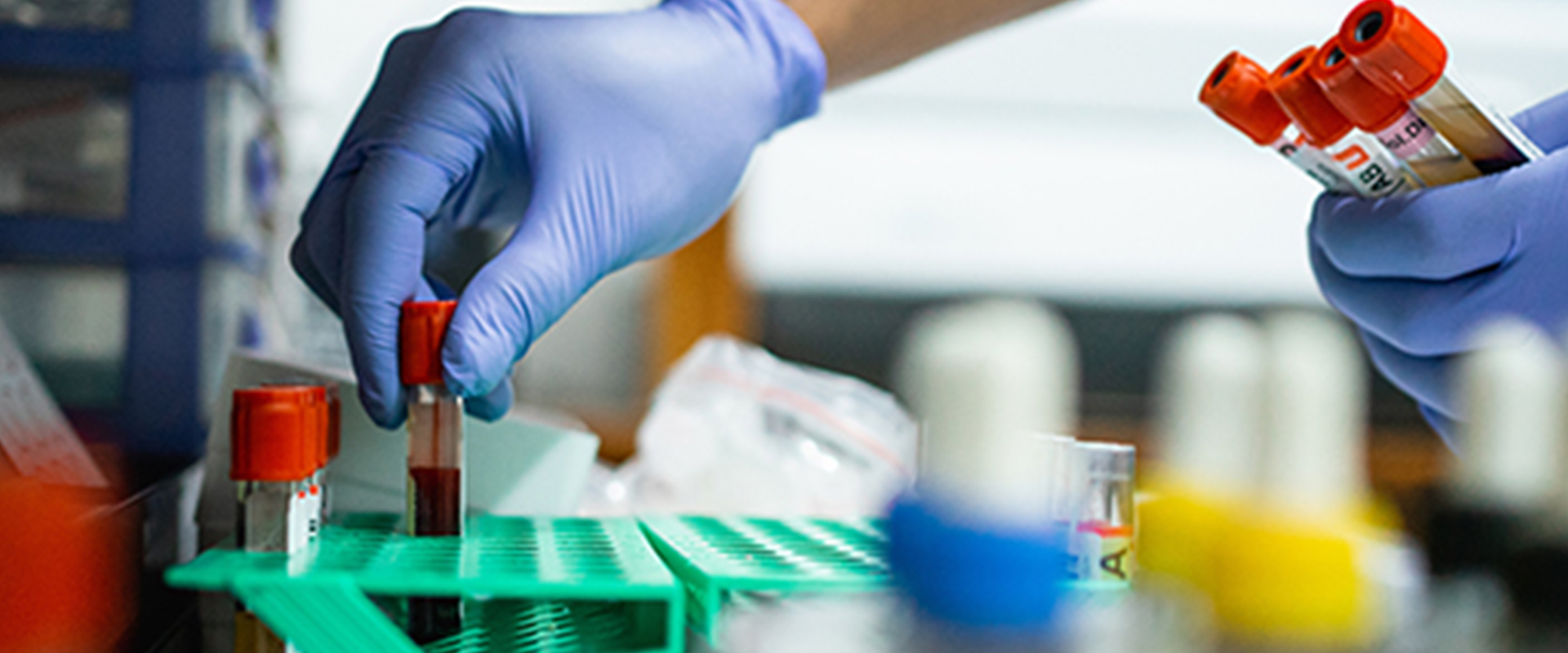 Precision Lab Diagnostics | Riverview DripsRiverview Drips